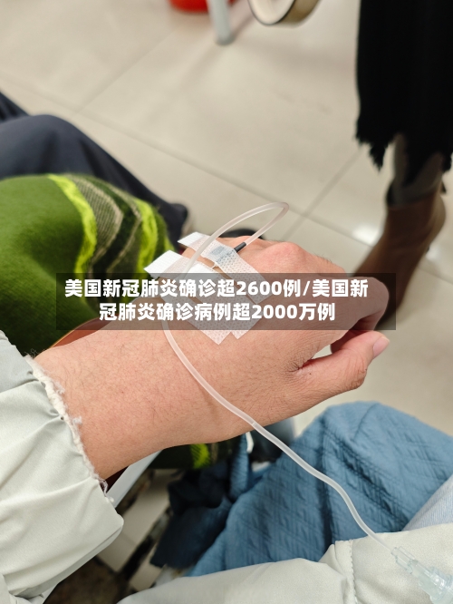 美国新冠肺炎确诊超2600例/美国新冠肺炎确诊病例超2000万例-第2张图片