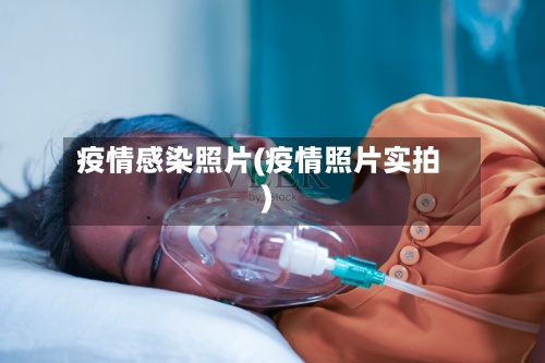 疫情感染照片(疫情照片实拍)-第2张图片