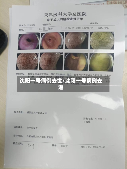 沈阳一号病例去世/沈阳一号病例去逝-第3张图片