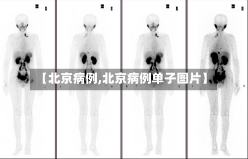 【北京病例,北京病例单子图片】